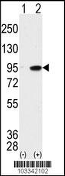 MAK Antibody (C-term)