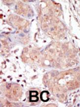 MAK Antibody (C-term)