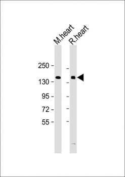 HIPK3 Antibody (C-term)
