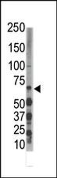 DYRK3 Antibody (N-term)