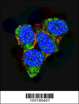 p21 (CDKN1A) Antibody (C-term)