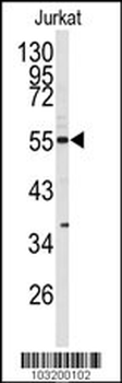 CDK8 Antibody (N-term)