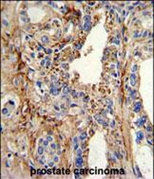 CDK4 Antibody (C-term)