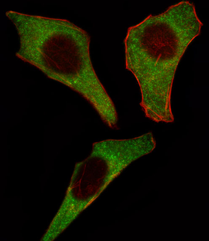 CDK4 Antibody (C-term)