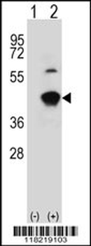GCAT Antibody (Center)