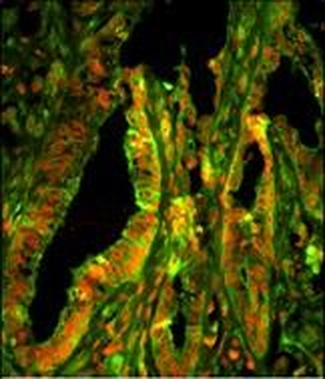 CAPZA1 Antibody (N-term)