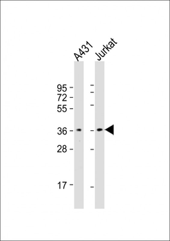 CAPZA1 Antibody (N-term)