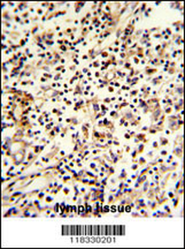 PCM-1 Antibody (C-term)