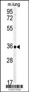 CA4 Antibody (C-term)