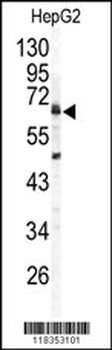 ARSB Antibody (C-term)