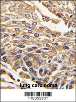 ARSB Antibody (C-term)