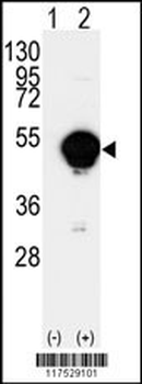 CYP20A1 Antibody (C-term)