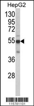 CYP2J2 Antibody (N-term)