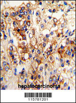 CYP2J2 Antibody (N-term)