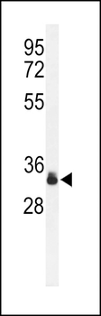 SPRY4-Y75 Antibody
