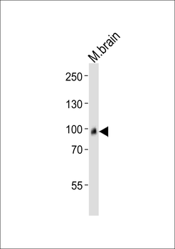 ADAMTS4 Antibody (C-term)