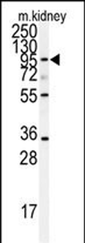ADAM9 Antibody (N-term)