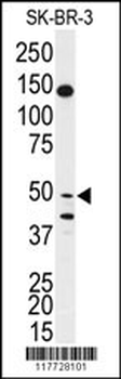 BPIL1 Antibody (N-term)