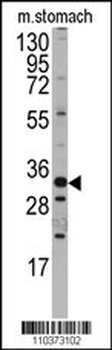 Mouse Hmx3 Antibody (C-term)