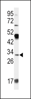 APOD Antibody (N-term)