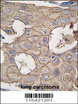 ANXA2 Antibody (N-term)