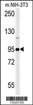 GIT1-Y554 Antibody (C-term)