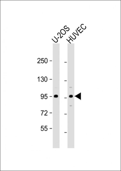 GIT1 Antibody (Center)