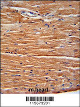 GIT1 Antibody (Center)