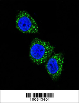 MEN1 Antibody (T594)