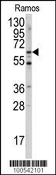MEN1 Antibody (S128)