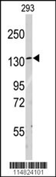 LARS Antibody (C-term)