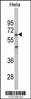AMPK2 Antibody (Center)