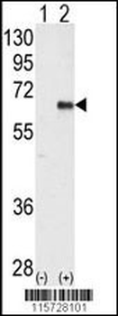AMPK2 Antibody (Center)