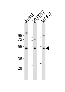 VRK1 Antibody (Center)