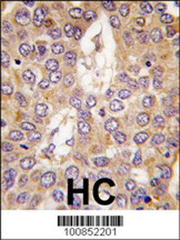 CSNK1G2 Antibody (C-term)