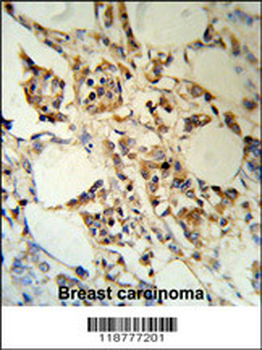 RBM3 Antibody (C-term)
