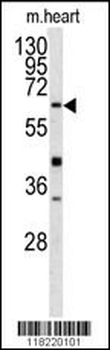 GGTLA1 Antibody (N-term)