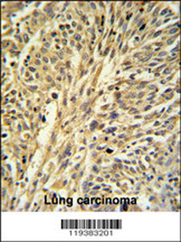 IMPDH2 Antibody (Center)