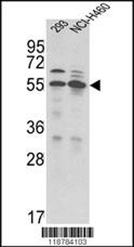 TMPRSS2 Antibody (N-term)