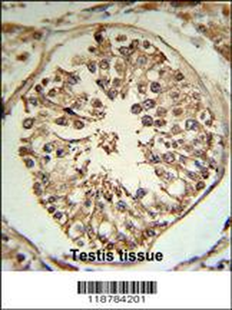 TMPRSS2 Antibody (N-term)