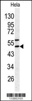 SERPINH1 Antibody (C-term)