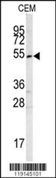 SMYD3 Antibody (Center)