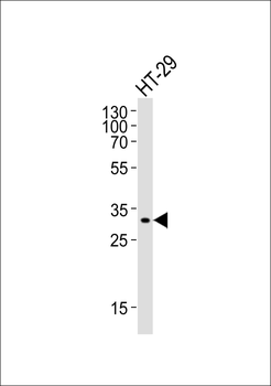 SMYD3 Antibody (Center)