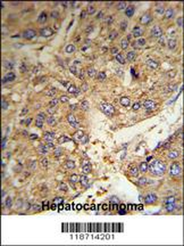 FGG Antibody (C-term)