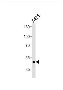 FGG Antibody (N-term)