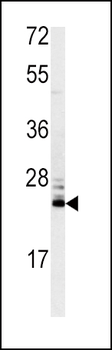 MSRA Antibody (N-term)