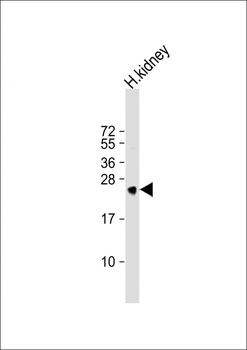 MSRA Antibody (N-term)