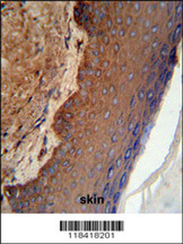 KRT9 Antibody (Center K317)