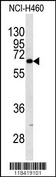 KRT9 Antibody (Center K444)