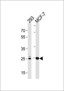CA2 Antibody (C-term)
